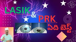 LASIK VS PRK WHAT TO CHOOSE  LASIK VS PRK ఏది బెస్ట్   TELUGU [upl. by Oicam18]