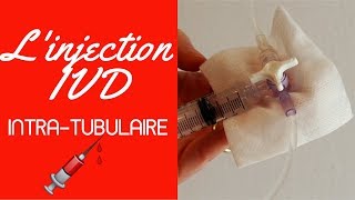 Injection IVD intra tubulaire [upl. by Michaud251]