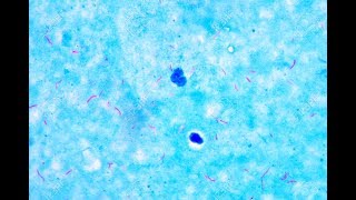 Mycobacterium under microscope afb positive [upl. by Ofelia]