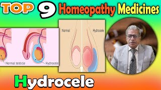 Hydrocele Causes Symptoms and homeopathy Treatment  Dr P S Tiwari [upl. by Manas]