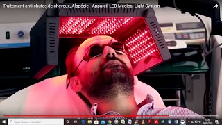 Traitement antichute stimulation de la pousse des cheveux alopécie  appareil LED MLS Dr Beilin [upl. by Naivart]