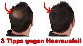 3 Tipps gegen Haarausfall [upl. by Bilicki595]