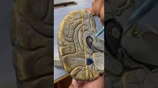 Cerebral hemisphere Sulci and Gyri Neuroanatomy [upl. by Jerad803]