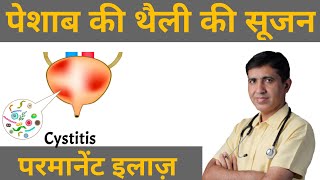 Cystitis  Bladder Pain Pesab Ki Theli Ki Sujan  Pesab Khulkar Nahi Aana  Homeopathy For Cystitis [upl. by Notgnilliw]