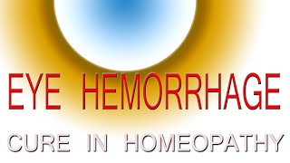 Eye hemorrhage cure in homeopathy [upl. by Landel666]