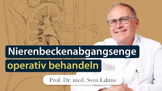 Nierenbeckenabgangsenge mit da Vinci Roboter operieren [upl. by Okim]