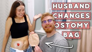 Husband Changes My Ostomy Bag FOR THE FIRST TIME EVER  Lets Talk IBD [upl. by Nylatsirhc]