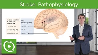 Stroke Pathophysiology  Clinical Neurology [upl. by Etteoj]