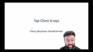 Top 8 Essential Chest XRay Findings Every Physician Should Know  Radiology Basics  USMLEStrike [upl. by Ahsinrac963]