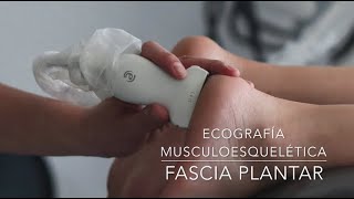 Importancia de la Ecografia en Fascitis Plantar [upl. by Enuahs373]