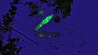 Freshwater ciliates stained acridine orange [upl. by Anisah]