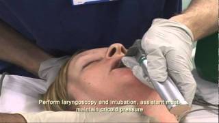 Intubation Extubation 37 [upl. by Yer]