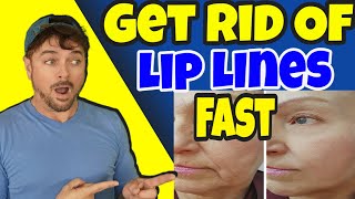 3 THINGS That Get Rid Of LIP LINES And WRINKLES  Chris Gibson [upl. by Oiramd]