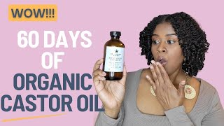 I Used CASTOR OIL for 60 days and THIS Happened [upl. by Assillam]