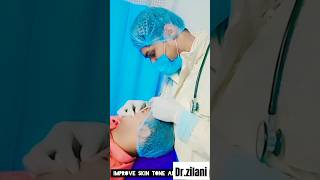 PRP treatment for dark acne spots 😳by Dr Zilani arzoohealthcare aiims medicos skincare ytshorts [upl. by Richmond]