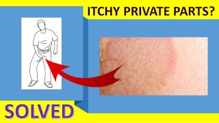 How To Cure Itching Near Private Parts  Itchy Groin Area Home Remedy [upl. by Perzan303]