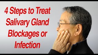 4 Steps to Treat Salivary Gland Swelling at Home [upl. by Ahseina]