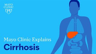 Mayo Clinic Explains Cirrhosis [upl. by Hornstein421]