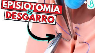 🪡✂️EPISIOTOMÍA VS DESGARRO ¿QUÉ ES MEJOR PARA EL PARTO  Baby Suite by Pau [upl. by Mckenna947]