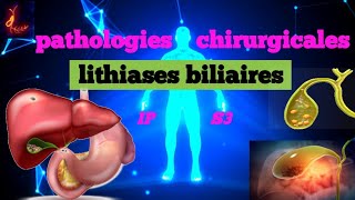 cours S3  Pathologies Chirurgicales et SI  Lithiases biliaires💊🩺💉🩸 شرح سهل 📚و 📚 مبسط للفهم [upl. by Eentihw]