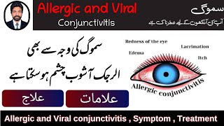 Smog Effect On Eyes  Allergic and Viral Conjunctivitis  Symptom Treatment Nafamine DrAHMandal [upl. by Naitsirhk796]