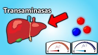 Transaminasas Altas EXPLICACIÓN EN 5 MINUTOS  Patología Clínica101 [upl. by Eppesiug]