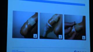 Symposium urologie prostaatkanker 6 december 2014  Anne Neirynck [upl. by Lecirg58]