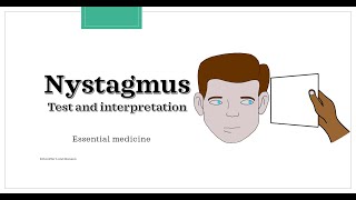 Nystagmus  test and interpretation Essential medicine [upl. by Alyakim]