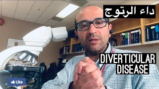 داء الرتوج Diverticular Disease [upl. by Enaed940]