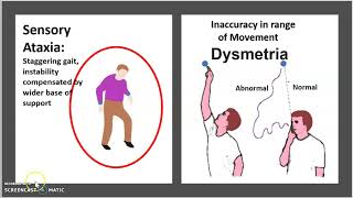 Friedreich’s ataxia Causes Symptoms Diagnosis Treatment Pathology USMLE NCLEX MCAT 3 minutes [upl. by Aimej]