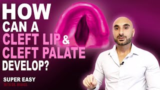 Cleft lip and Cleft Palate Surgery V1 [upl. by Gauldin]