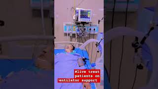 Ventilator Patients How to Save Them [upl. by Oht]