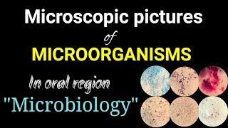 Microscopic pictures of microorganismsmicrobiology pictures of microorganismsDr Poojireddy [upl. by Eikcid]