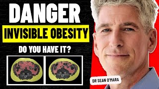 Unseen Epidemic How Visceral Fat Leads to Chronic Disease  Dr Sean OMara [upl. by Win]