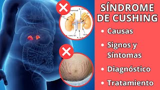 SÍNDROME DE CUSHING  Causas signos y síntomas diagnóstico y tratamiento [upl. by Alyekahs717]