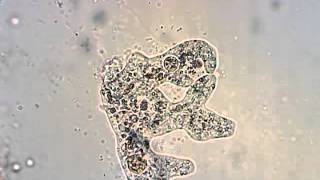 Amoeba from a pond in Oregon feeding and division [upl. by Hullda]