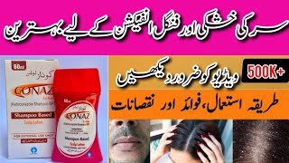 conaz shampoo benefits  conaz shampoo side effects  conaz lotion shampoo uses in urdu [upl. by Fryd214]