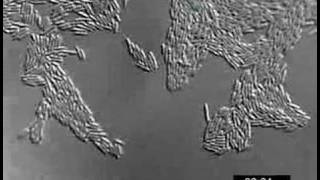 Pseudomonas aeruginosa twitching motility YFPPilU [upl. by Anecuza692]