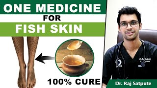 One Medicine To Cure Ichthyosis Vulgaris FISH SKIN  How to Cure FISH SKIN Naturally amp Permanently [upl. by Ontine]