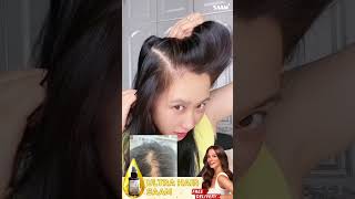 Reduce hair loss only with 1 piece of Ultra Hair Growth Spray hairloss hairlosstreatment haircare [upl. by Elrahc]