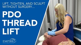 How does a PDO Thread Lift work to lift tighten and sculpt without surgery [upl. by Dopp]