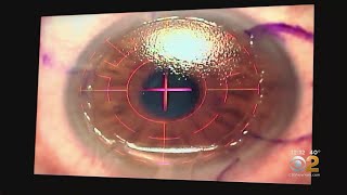 Doctors Warn Of Complications Surrounding LASIK Eye Surgery [upl. by Compte992]