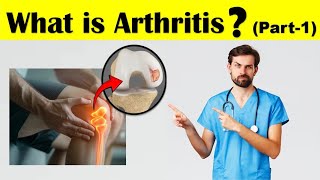 What is Arthritis  Anatomy of JointHealthyArthritis Different Types of Arthritis  Part1 [upl. by Beatty]