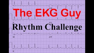 EKGECG  Rhythm Challenge 120  The EKG Guy [upl. by Enrika337]