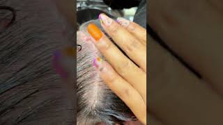 Scalp Treatment and Combing for Dry Scalp scalptreatment [upl. by Jennine]