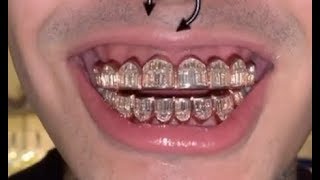 Lil Pump Spends 1M On Rose Gold Baguette Diamond Grill [upl. by Attiuqram111]