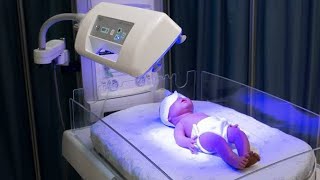 Phototherapy Treatment For Jaundice  Phototherapy In Newborn  Phototherapy Treatment [upl. by Selinda]