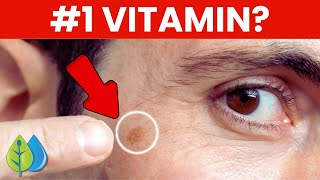 Top 3 Nutrients to Remove Age Spots [upl. by Comstock]