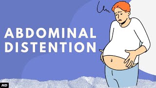 Abdominal Distention Everything You Need To Know [upl. by Punke]