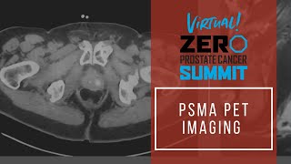 PSMA PET Imaging  Summit 2021 [upl. by Bran]